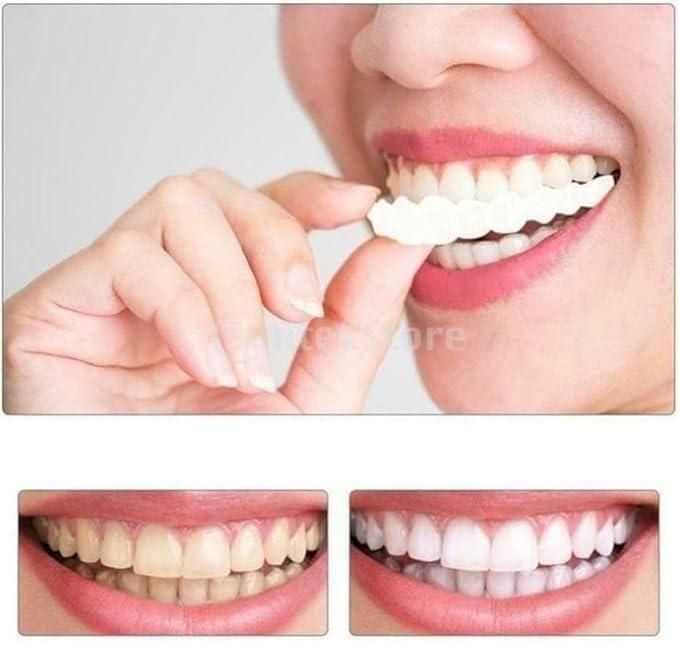 Temporary Teeth Braces Cover